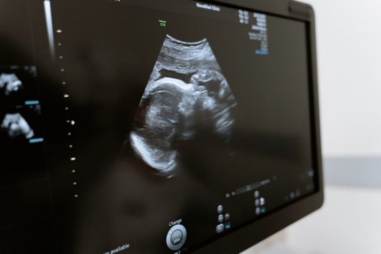 Termometr owulacyjny, czyli naturalna metoda planowania rodziny i…antykoncepcji. Przeczytaj, jeśli planujesz zajść w ciążę